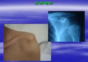 IM电竞官网-法兰克福围绕西甲强势反弹托特纳姆赛前迎来里程碑，马德里竞技围绕意大利杯单刀错失瞬间刷屏的简单介绍